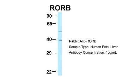 Western Blot: ROR beta Antibody [NBP2-88172]