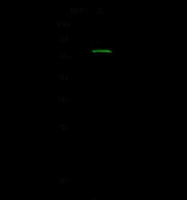 Western Blot: ROR beta Antibody [NBP2-98863]