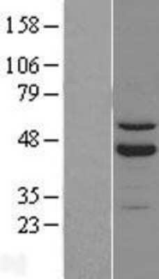 Western Blot: ROR beta Overexpression Lysate [NBL1-15481]