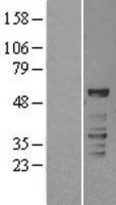 Western Blot: ROR gamma/RORC/NR1F3 Overexpression Lysate [NBL1-15482]