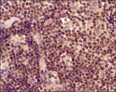 Immunohistochemistry-Paraffin: ROR gamma/RORC/NR1F3 Antibody - BSA Free [NBP2-24503]