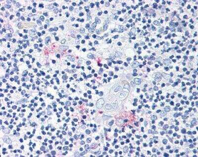 Immunohistochemistry-Paraffin: ROR gamma/RORC/NR1F3 Antibody - BSA Free [NLS5188]