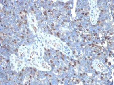 Immunohistochemistry-Paraffin: ROR gamma/RORC/NR1F3 Antibody (RORC/2941) [NBP3-07564]