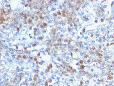 Immunohistochemistry-Paraffin: ROR gamma/RORC/NR1F3 Antibody (RORC/2941) [NBP3-07564]