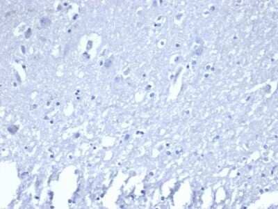 Immunohistochemistry-Paraffin: ROR gamma/RORC/NR1F3 Antibody (RORC/2941) [NBP3-07564]