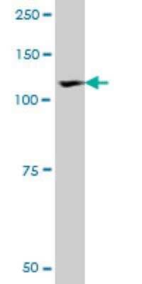 Western Blot: ROR1 Antibody (2F8) [H00004919-M01]