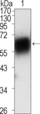 Western Blot: ROR1 Antibody (2H6)BSA Free [NBP1-47449]