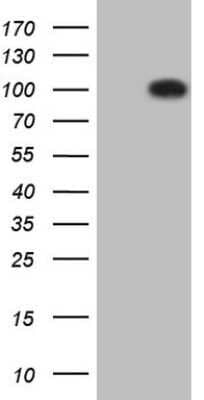 Western Blot: ROR1 Antibody (OTI3D11)Azide and BSA Free [NBP2-73931]