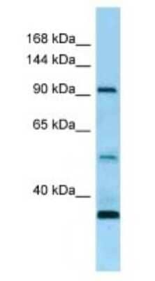 Western Blot: ROR1 Antibody [NBP1-98395]