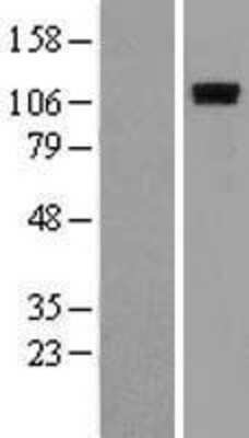 Western Blot: ROR1 Overexpression Lysate [NBL1-15477]