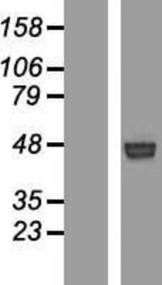 Western Blot: ROR1 Overexpression Lysate [NBP2-08430]