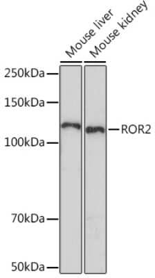 Western Blot: ROR2 Antibody (0B7X8) [NBP3-16564]