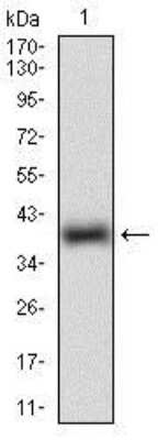 Western Blot: ROR2 Antibody (6F2D10)BSA Free [NBP2-37263]