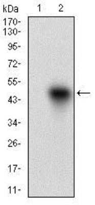 Western Blot: ROR2 Antibody (6F2D10)BSA Free [NBP2-37263]