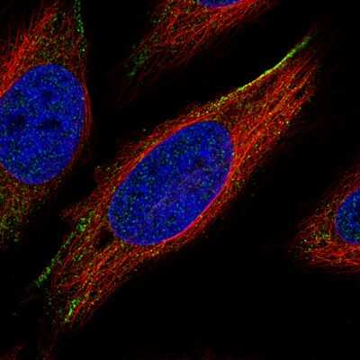 Immunocytochemistry/ Immunofluorescence: ROR2 Antibody (CL5950) [NBP2-61434]