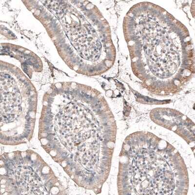 Immunohistochemistry-Paraffin: ROR2 Antibody (CL5950) [NBP2-61434]