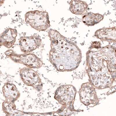 Immunohistochemistry-Paraffin: ROR2 Antibody (CL5950) [NBP2-61434]