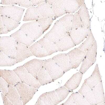 Immunohistochemistry-Paraffin: ROR2 Antibody (CL5950) [NBP2-61434]