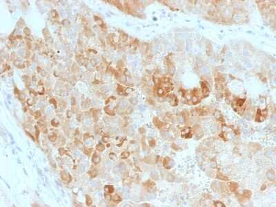 Immunohistochemistry-Paraffin: ROR2 Antibody (ROR2/1911) - Azide and BSA Free [NBP3-08532]