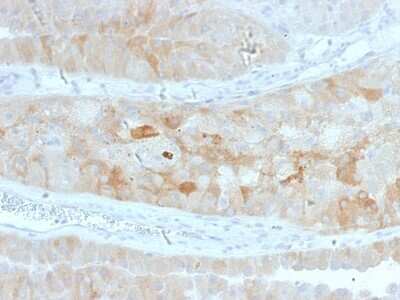 Immunohistochemistry-Paraffin: ROR2 Antibody (ROR2/1912) - Azide and BSA Free [NBP3-08784]