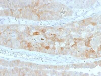 Immunohistochemistry-Paraffin: ROR2 Antibody (ROR2/1912) [NBP3-07462]