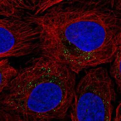 Immunocytochemistry/ Immunofluorescence: ROS Antibody [NBP2-56053]