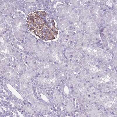 Immunohistochemistry-Paraffin: ROS Antibody [NBP2-13245]