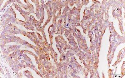 Immunohistochemistry-Paraffin: ROS Antibody [NBP2-13245]