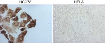 Immunohistochemistry-Paraffin: ROS Antibody (OTI1A1) [NBP2-45627]