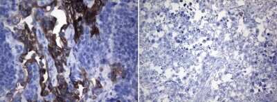 Immunohistochemistry-Paraffin: ROS Antibody (OTI1A1) [NBP2-45627]
