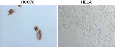 Immunohistochemistry: ROS Antibody (OTI1F3) - Azide and BSA Free [NBP2-73932]