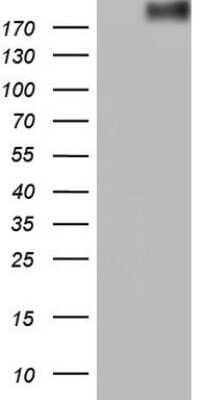 Western Blot: ROS Antibody (OTI1F3)Azide and BSA Free [NBP2-73932]