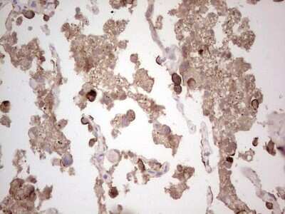 Immunohistochemistry: ROS Antibody (OTI1F3) [NBP2-45626]