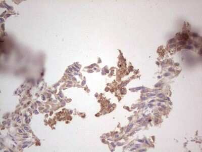 Immunohistochemistry: ROS Antibody (OTI1F3) [NBP2-45626]