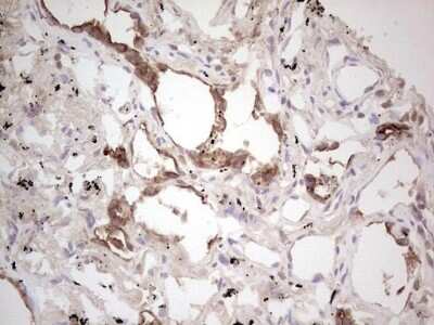 Immunohistochemistry: ROS Antibody (OTI1F3) [NBP2-45626]