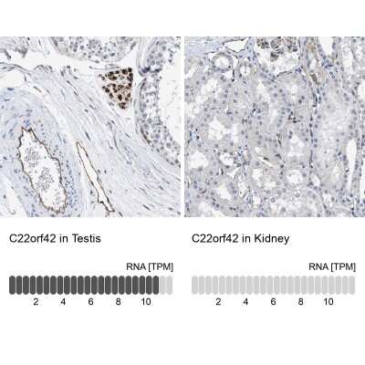 Immunohistochemistry-Paraffin: RP1-127L4.6 Antibody [NBP1-91083]