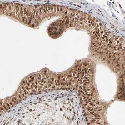 Immunohistochemistry-Paraffin: RP1-199H16.5 Antibody [NBP1-91201]