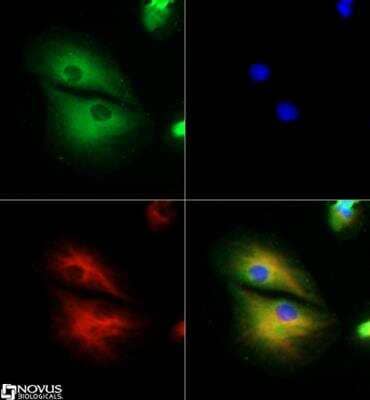 Immunocytochemistry/ Immunofluorescence: RP1 Antibody - BSA Free [NBP2-22149]