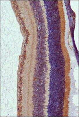 Immunohistochemistry: RP1 Antibody - BSA Free [NBP2-22149]