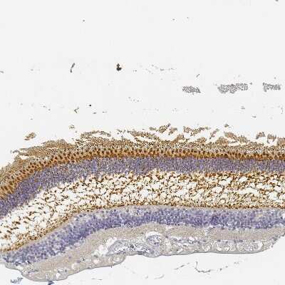 Immunohistochemistry-Paraffin: RP1 Antibody [NBP1-90597]