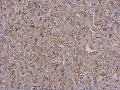 Immunohistochemistry-Paraffin: RP105/CD180 Antibody [NBP2-20204]