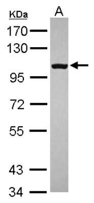 Western Blot: RP105/CD180 Antibody [NBP2-20204]