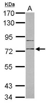 Western Blot: RP105/CD180 Antibody [NBP2-20205]