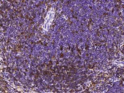Immunohistochemistry-Paraffin: RP105/CD180 Antibody (105) [NBP2-90611]