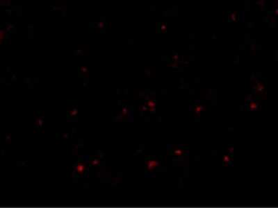 Immunocytochemistry/ Immunofluorescence: RP105/CD180 Antibody - BSA Free [NBP1-76706]