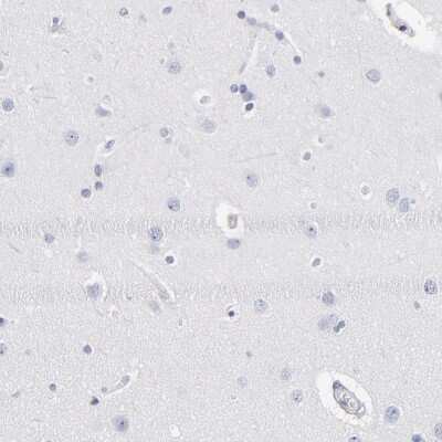 Immunohistochemistry-Paraffin: RP105/CD180 Antibody [NBP1-87727]
