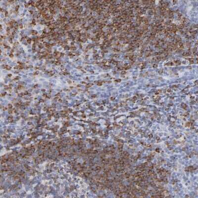 Immunohistochemistry-Paraffin: RP105/CD180 Antibody [NBP1-87727]