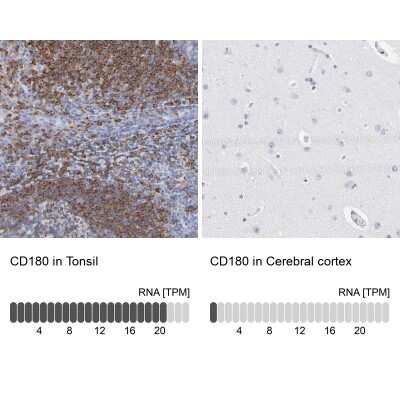 Immunohistochemistry-Paraffin: RP105/CD180 Antibody [NBP1-87727]