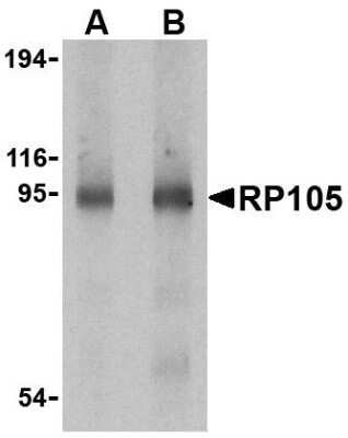 Western Blot: RP105/CD180 AntibodyBSA Free [NBP1-76705]