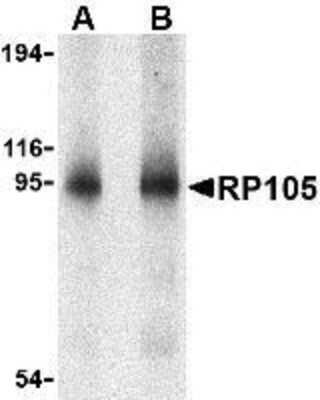 Western Blot: RP105/CD180 AntibodyBSA Free [NBP1-76706]